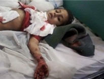 جدیدترین آمار از قربانیان حمله عربستان به یمن