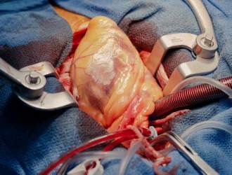 تکنولوژی جراحان قلب را بیکار  می‌کند!